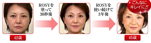 agos �r���[�e�B�[�N���j�b�N�������l�b�g